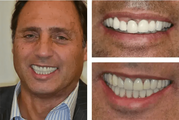 Before and after dental treatment results in Hollister Family Dental & Implant Center